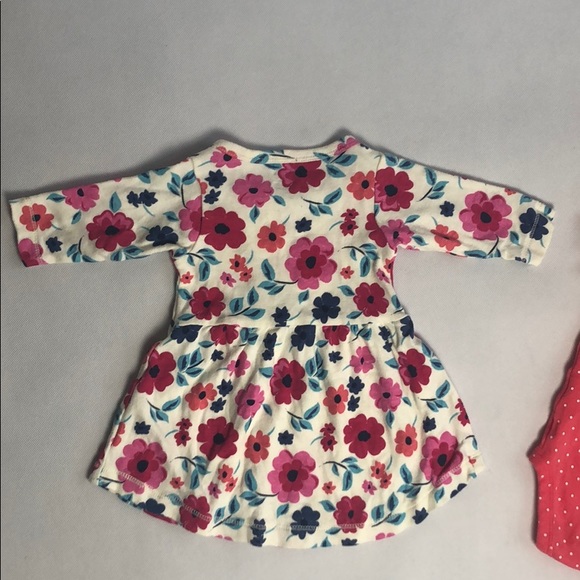 Baby Dress/Onesie Clothing Bundle - Picture 4 of 7